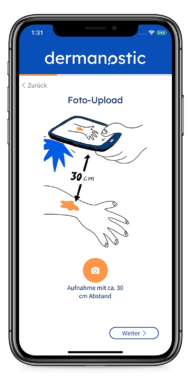 Covid19 – Chancen der Medizin: Hautarzt per App